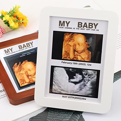מסגרת תמונה של סונוגרמה לתינוק אולטרסאונד מסגרת תמונה הודעת הריון